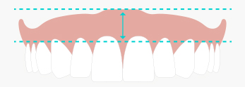 teeth_a1.jpg