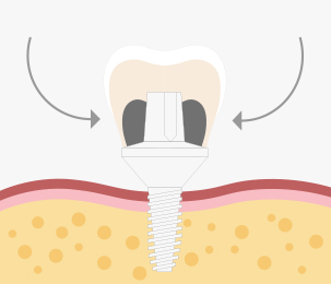 teeth_f3.jpg